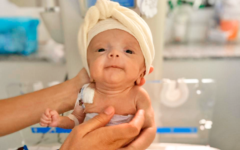 Projeto de lei institui ações de prevenção à prematuridade